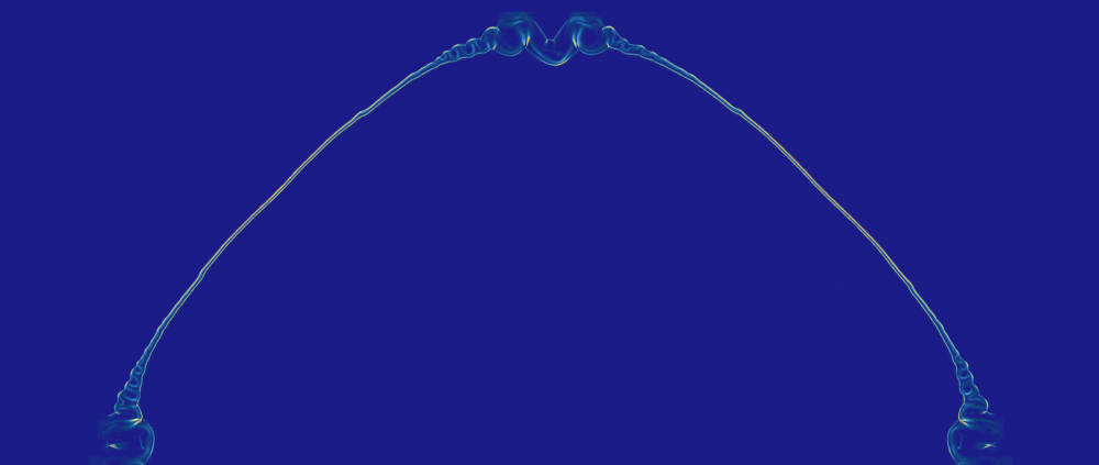 gradR_base_finemesh_scheme.png